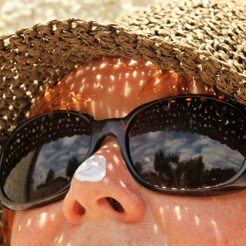 Sunscreen on a nose near sunglasses to illustrate Skinbetter Science products needed in summer